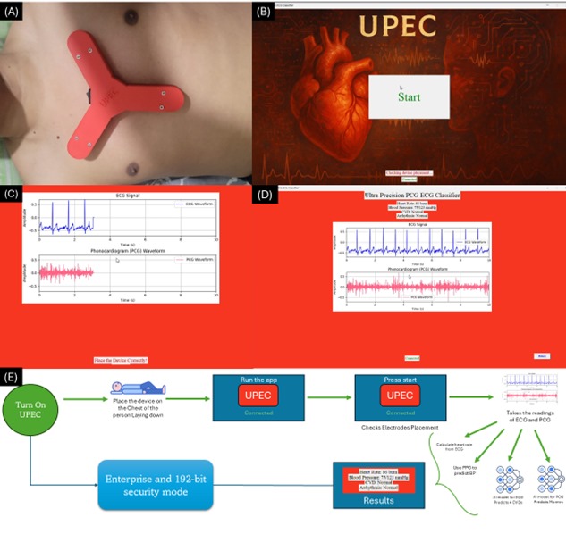 Rana Talha Khalid - UPEC AI-Powered Cardiac Diagnostics Device Project